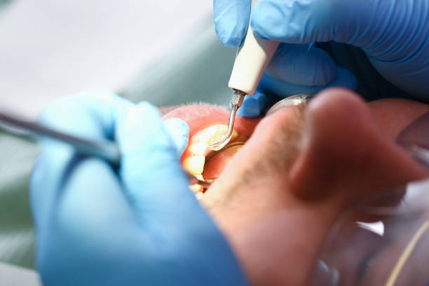 Best Weekend Emergency Dentist in Laureldale, PA